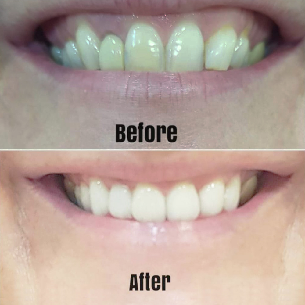 Goa dental studio is a one-stop destination for your complete dental treatment