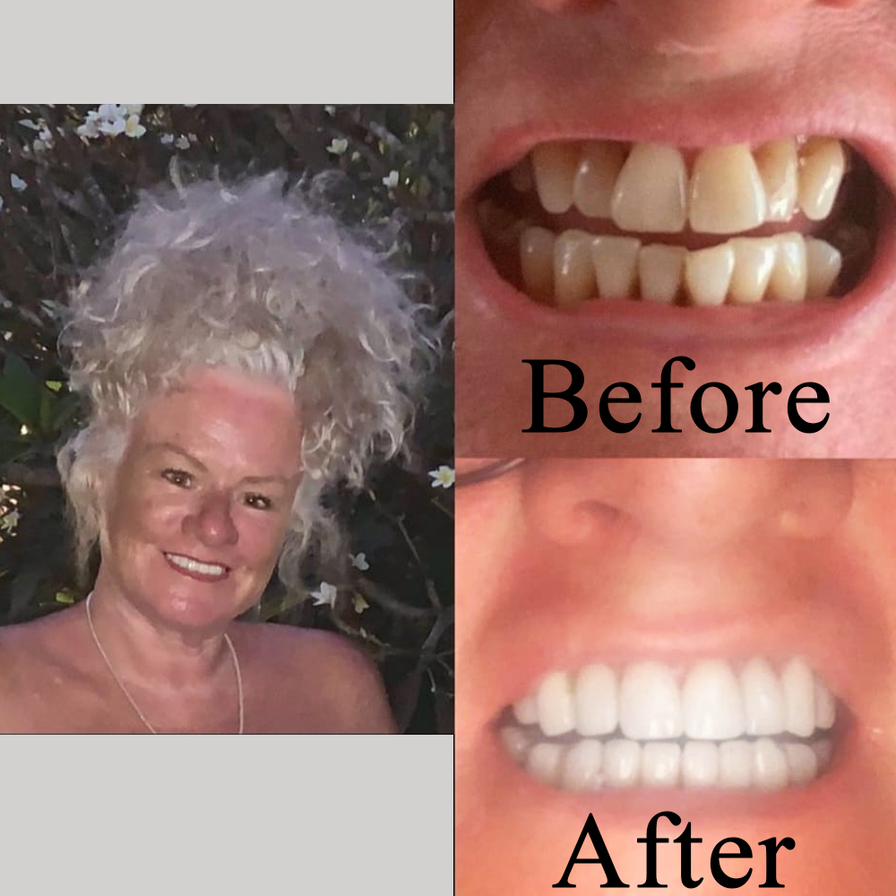 Goa dental studio is a one-stop destination for your complete dental treatment