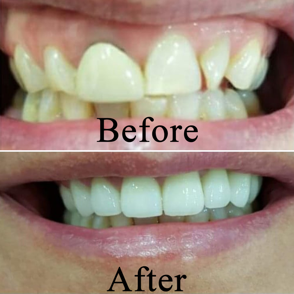Goa dental studio is a one-stop destination for your complete dental treatment