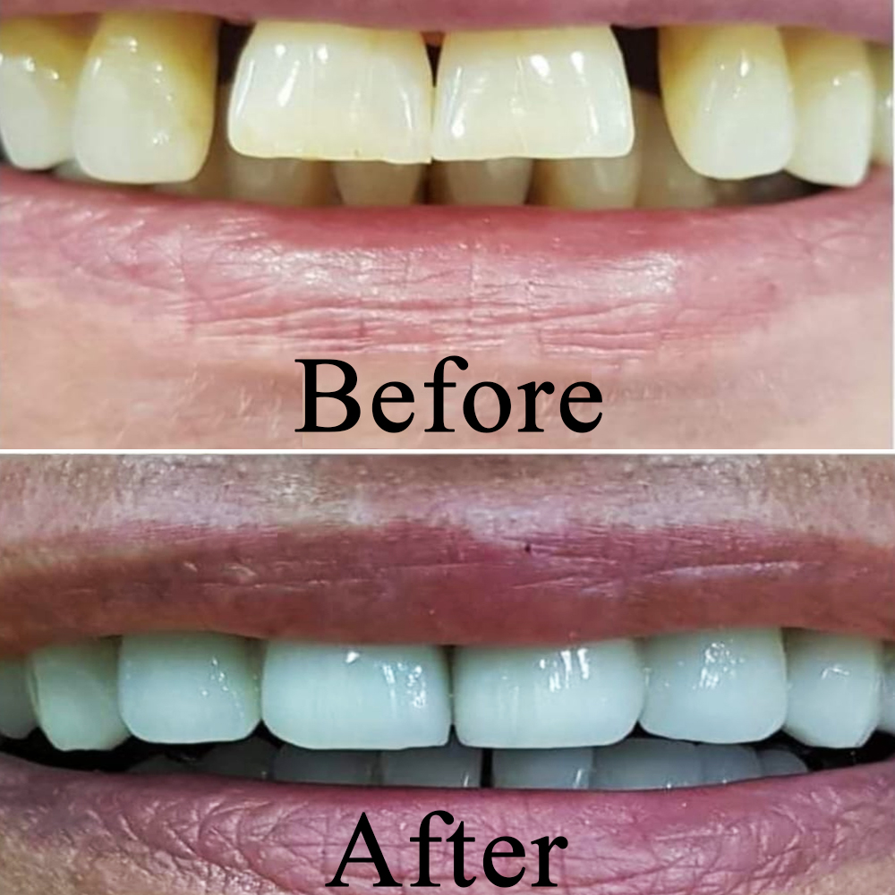 Goa dental studio is a one-stop destination for your complete dental treatment