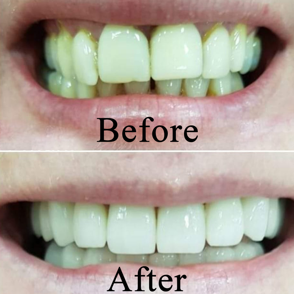 Goa dental studio is a one-stop destination for your complete dental treatment