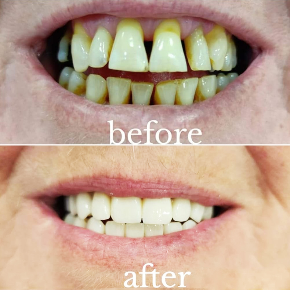 Goa dental studio is a one-stop destination for your complete dental treatment