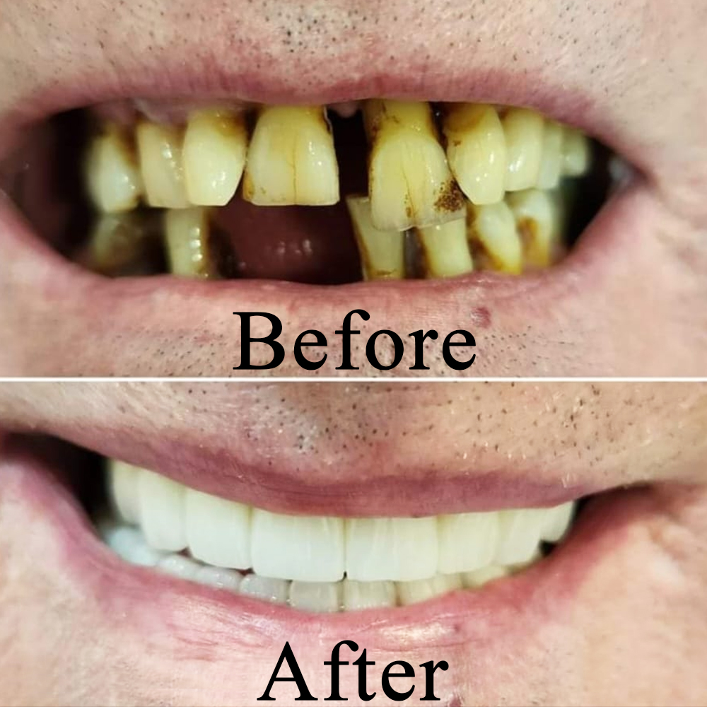 Goa dental studio is a one-stop destination for your complete dental treatment