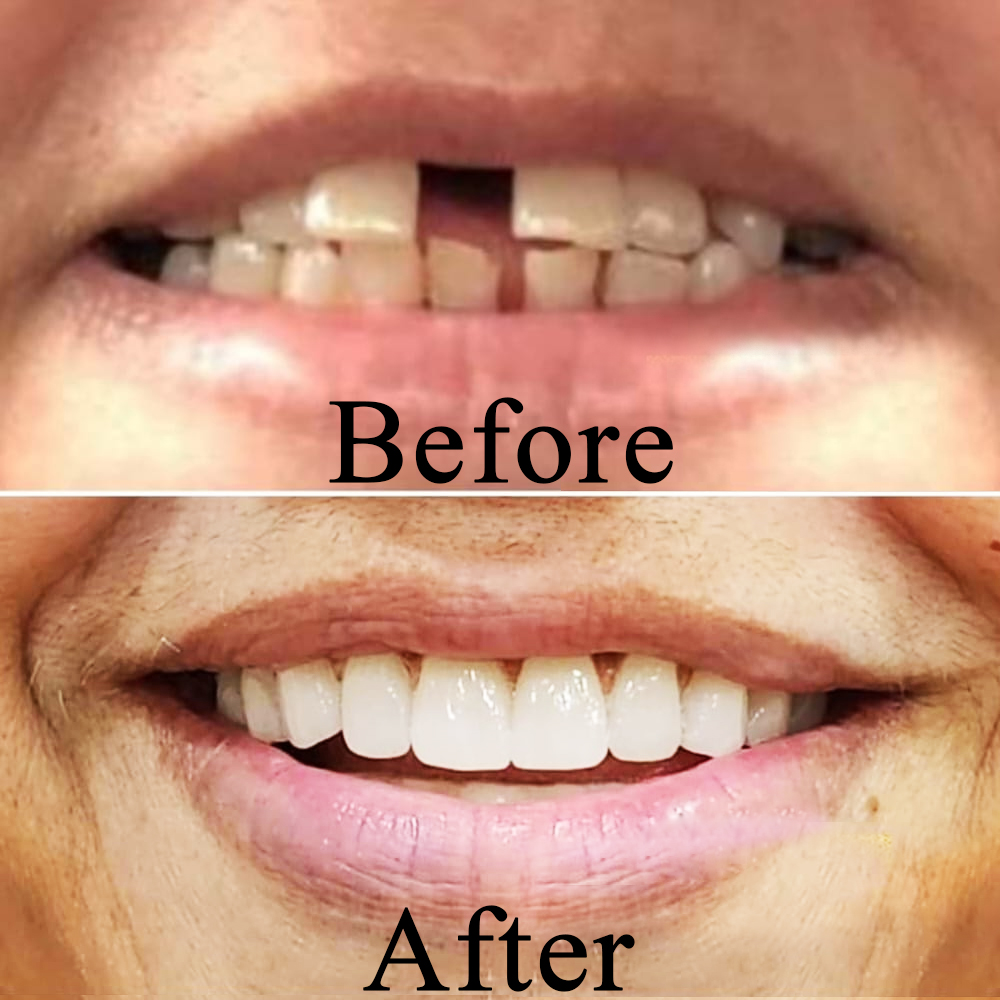 Goa dental studio is a one-stop destination for your complete dental treatment