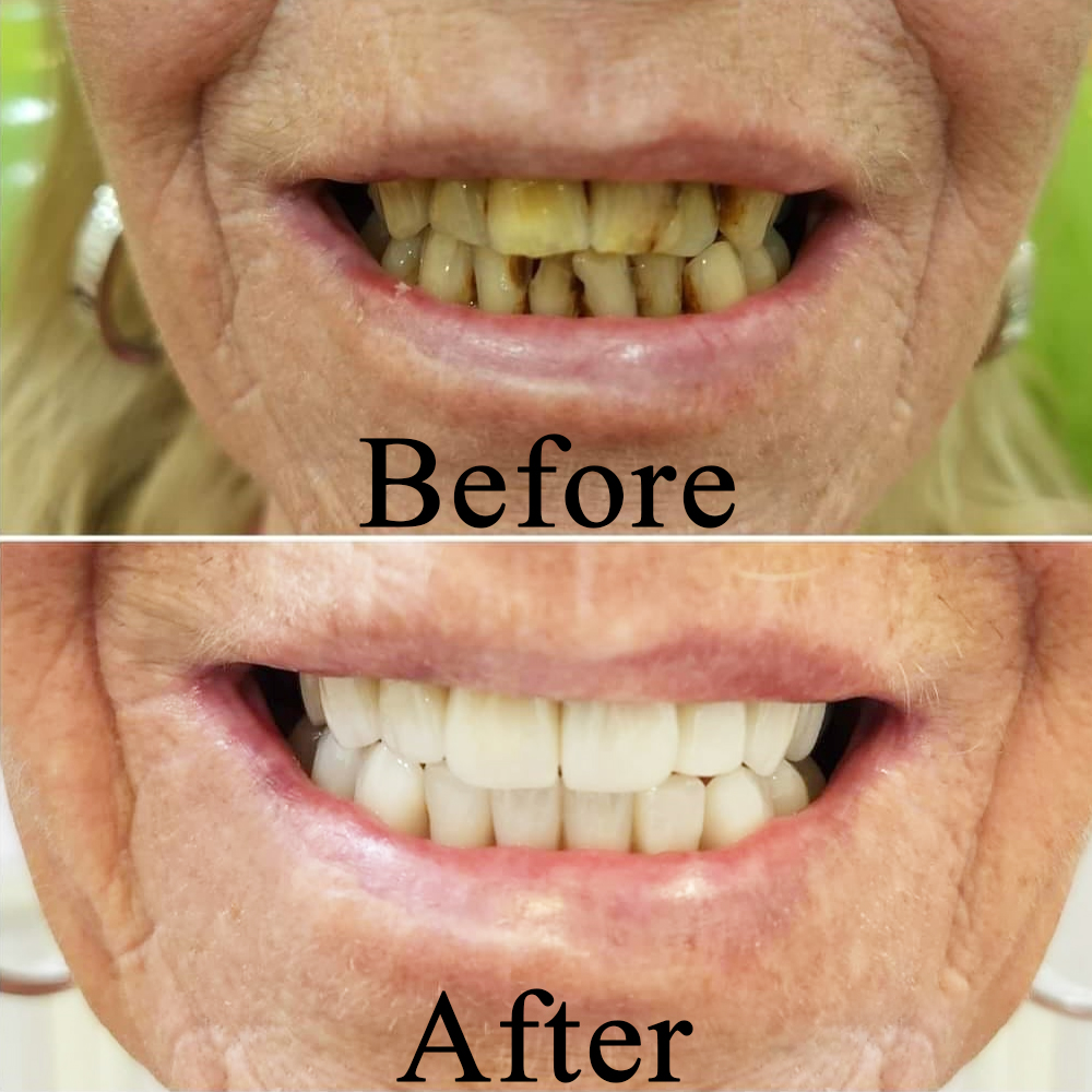 Goa dental studio is a one-stop destination for your complete dental treatment