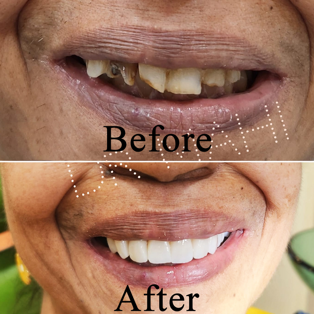 Goa dental studio is a one-stop destination for your complete dental treatment