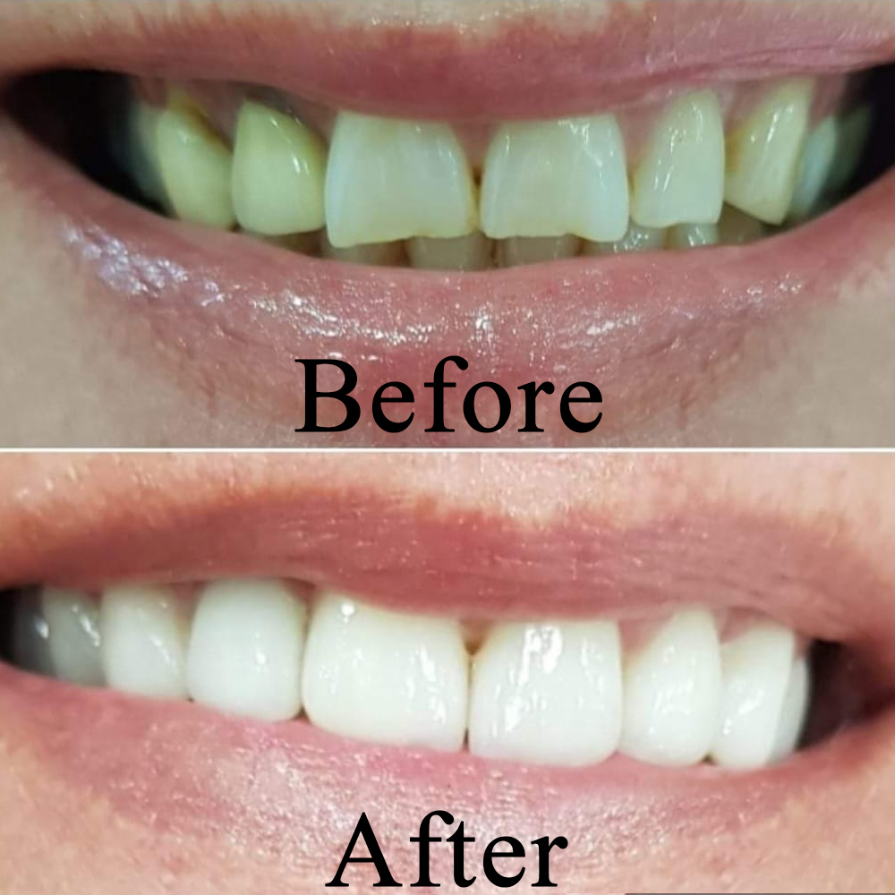 Goa dental studio is a one-stop destination for your complete dental treatment