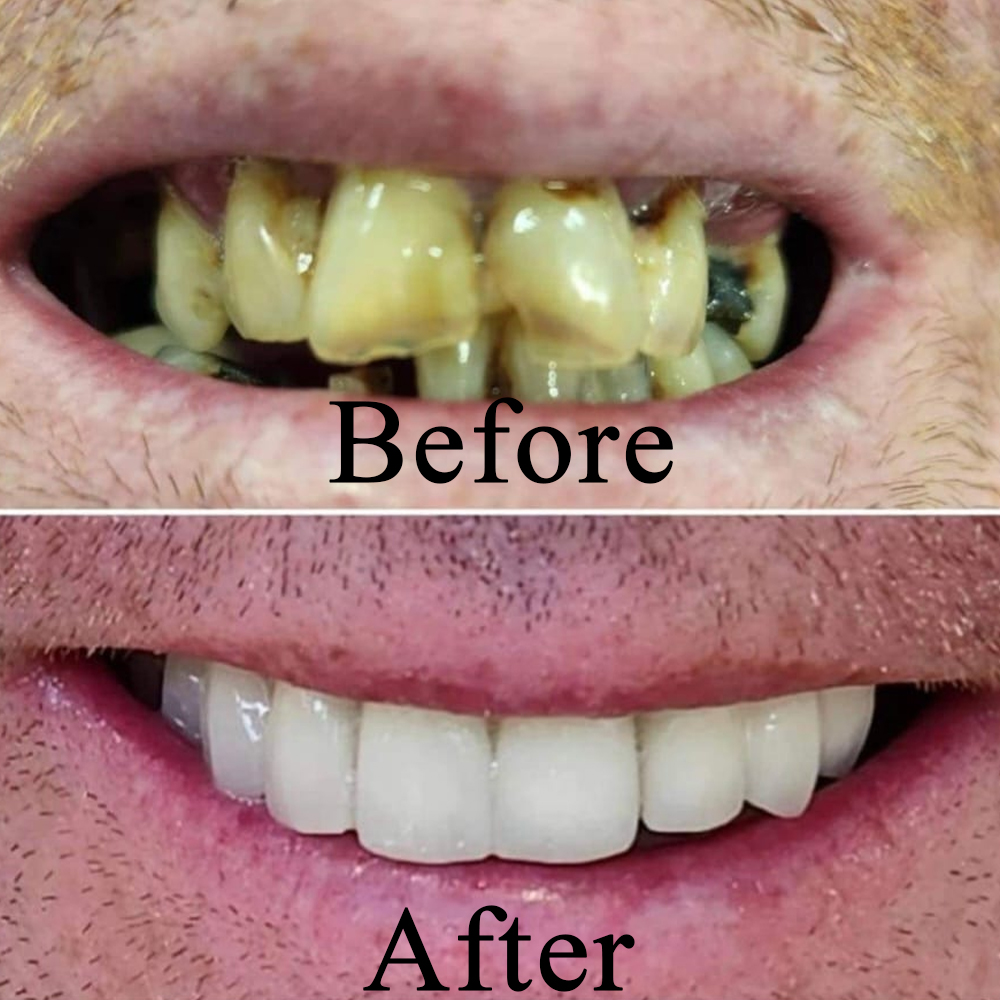 Goa dental studio is a one-stop destination for your complete dental treatment